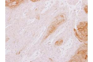 IHC-P Image TXNDC3 antibody [N3C3] detects TXNDC3 protein at cytoplasm on Cal27 xenograft by immunohistochemical analysis. (TXNDC3/NME8 抗体  (Center))