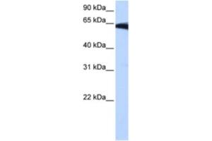 Western Blotting (WB) image for anti-Phosphatidylinositol Glycan W (PIGW) antibody (ABIN2463266) (PIGW 抗体)