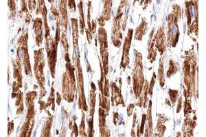 ABIN6266951 at 1/100 staining human Heart muscle tissue sections by IHC-P. (DOK7 抗体  (C-Term))