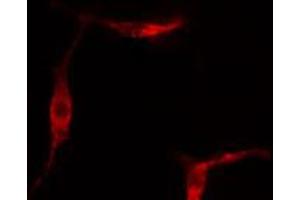 ABIN6267332 staining Hela cells by IF/ICC. (Ret Proto-Oncogene 抗体  (pTyr1062))