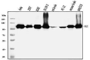 Western blot analysis of HGS using anti-HGS antibody (ABIN7601206).