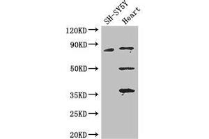 Western Blot Positive WB detected in: SH-SY5Y whole cell lysate, Mouse heart tissue All lanes: MAPT antibody at 3. (MAPT 抗体  (AA 33-166))