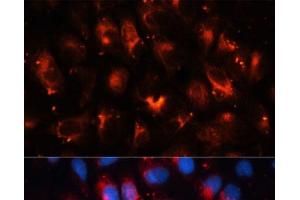 Immunofluorescence analysis of U-2OS cells using RALA Polyclonal Antibody at dilution of 1:100. (rala 抗体)