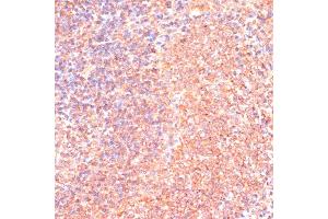 Immunohistochemistry of paraffin-embedded rat spleen using IL4R antibody (ABIN7268001) at dilution of 1:100 (40x lens). (IL4 Receptor 抗体  (AA 26-232))