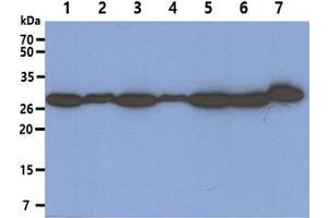 anti-Proteasome (Prosome, Macropain) Activator Subunit 1 (PA28 Alpha) (PSME1) (AA 1-249) antibody