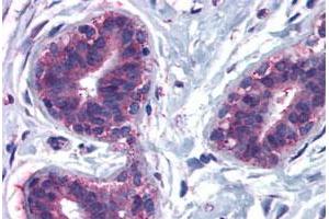 Immunohistochemical staining of human breast, lobular epithelium with CELSR2 polyclonal antibody . (CELSR2 抗体  (N-Term))