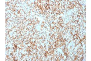 Immunohistochemistry (IHC) image for anti-5'-Nucleotidase, Ecto (CD73) (NT5E) antibody (ABIN6940227)