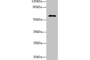 Western blot All lanes: GK5 antibody at 4 μg/mL + K562 whole cell lysate Secondary Goat polyclonal to rabbit IgG at 1/10000 dilution Predicted band size: 60, 34, 28 kDa Observed band size: 60 kDa (GK5 抗体  (AA 96-301))