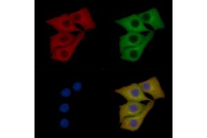 PSD95 Mouse Monoclonal Antibody staining Hela cells by IF/ICC.