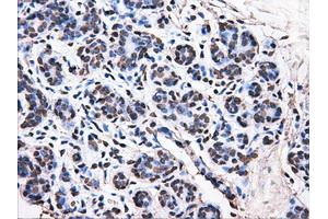 Immunohistochemical staining of paraffin-embedded breast tissue using anti-ATP5B mouse monoclonal antibody. (ATP5B 抗体)
