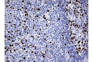 Image no. 2 for anti-Antigen Identified By Monoclonal Antibody Ki-67 (MKI67) (AA 1160-1493) antibody (ABIN1490859) (Ki-67 抗体  (AA 1160-1493))