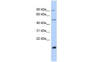 Human MCF-7; WB Suggested Anti-ZNF645 Antibody Titration: 0. (ZNF645 抗体  (Middle Region))