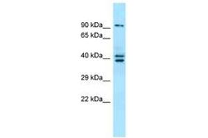 Image no. 1 for anti-L(3)mbt-Like 3 (L3MBTL3) (N-Term) antibody (ABIN6744892) (L3MBTL3 抗体  (N-Term))