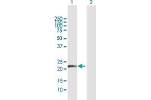 Western Blotting (WB) image for anti-NADH Dehydrogenase (Ubiquinone) 1 beta Subcomplex, 10, 22kDa (NDUFB10) (AA 1-172) antibody (ABIN518244)