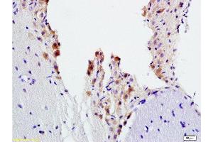 Formalin-fixed and paraffin embedded rat brain tissue labeled with Anti-ADRB2 Polyclonal Antibody, Unconjugated  at 1:200, followed by conjugation to the secondary antibody and DAB staining (beta 2 Adrenergic Receptor 抗体  (AA 201-300))