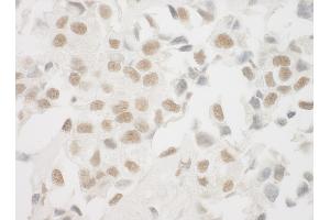 Immunohistochemistry (IHC) image for anti-X-Ray Repair Complementing Defective Repair in Chinese Hamster Cells 6 (XRCC6) (AA 559-609) antibody (ABIN7448626)