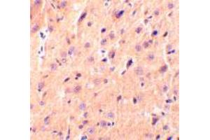 Immunohistochemical staining of rat brain tissue using CBLN1 polyclonal antibody  at 2 ug/mL . (CBLN1 抗体  (Internal Region))