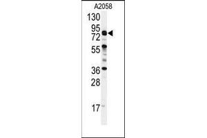 Western blot analysis of anti-COG4 Antibody (C-term) in A2058 cell line lysates (35ug/lane). (COG4 抗体  (C-Term))