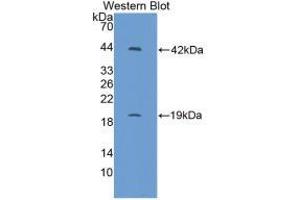 Western blot analysis of recombinant Mouse IL1R1. (IL1R1 抗体  (AA 20-338))