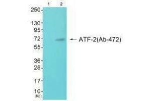 Western blot analysis of extracts from JK cells (Lane 2), using ATF-2 (Ab-472) antiobdy. (ATF2 抗体  (Ser472))
