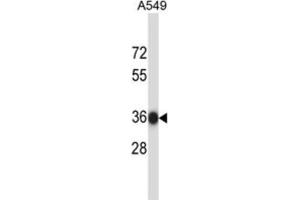 Western Blotting (WB) image for anti-N-Ethylmaleimide Sensitive Fusion Protein Attachment Protein beta (NAPB) antibody (ABIN2997844) (NAPB 抗体)