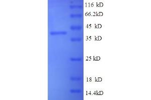 SDS-PAGE (SDS) image for Induced Myeloid Leukemia Cell Differentiation Protein Mcl-1 (MCL1) (AA 1-308), (partial) protein (His-SUMO Tag) (ABIN5709917) (MCL-1 Protein (AA 1-308, partial) (His-SUMO Tag))