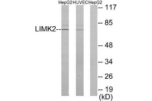 Western Blotting (WB) image for anti-LIM Domain Kinase 2 (LIMK2) (Internal Region) antibody (ABIN1849456) (LIMK2 抗体  (Internal Region))