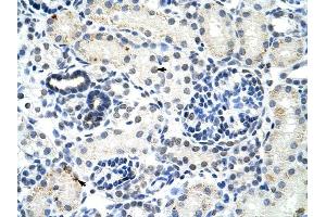 DDX17 antibody was used for immunohistochemistry at a concentration of 4-8 ug/ml to stain Epithelial cells of renal tubule (arrows) in Human Kidney. (DDX17 抗体)