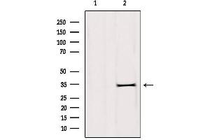 Western blot analysis of extracts from rat brain, using DHRS1 Antibody.