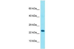 Western Blotting (WB) image for anti-GRB2-Related Adaptor Protein (GRAP) (N-Term) antibody (ABIN2791566) (GRAP 抗体  (N-Term))