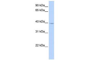 IQCD antibody used at 1 ug/ml to detect target protein. (IQCD 抗体  (N-Term))
