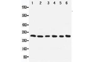 Anti-Apoptosis repressor with CARD antibody, Western blotting Lane 1: SMMC Cell Lysate Lane 2: A549 Cell Lysate Lane 3: U87 Cell Lysate Lane 4: HELA Cell Lysate Lane 5: MCF-7 Cell Lysate Lane 6: Rat Liver Tissue Lysate
