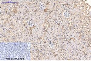 Immunohistochemistry (IHC) image for anti-Complement Component (3d/Epstein Barr Virus) Receptor 2 (CR2) antibody (ABIN5961549) (CD21 抗体)