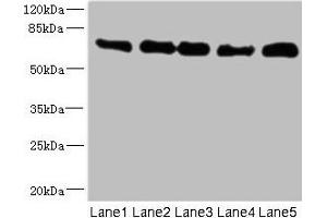 Western blot All lanes: NUMB antibody at 0. (NUMB 抗体  (AA 532-651))