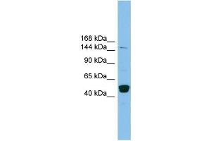 WB Suggested Anti-PRDM10 Antibody Titration: 0. (PRDM10 抗体  (Middle Region))