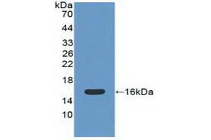 Detection of Recombinant CAT, Mouse using Polyclonal Antibody to Catalase (CAT) (Catalase 抗体  (AA 32-157))