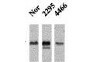 Image no. 1 for anti-Calcium/calmodulin-Dependent Protein Kinase II beta (CAMK2B) (pThr286), (Thr287) antibody (ABIN466897) (CAMK2B 抗体  (pThr286, Thr287))