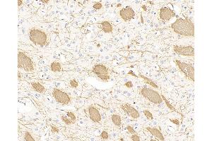 Immunohistochemistry analysis of paraffin-embedded mouse brain using MBP Polyclonal Antibody at dilution of 1:300. (MBP 抗体)
