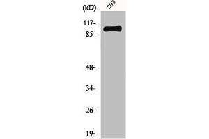 Western Blot analysis of 293 cells using mGluR-4 Polyclonal Antibody (Metabotropic Glutamate Receptor 4 抗体  (C-Term))