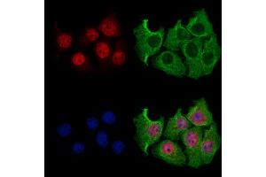 SLFN11 Antibody staining HepG2 cells by IF/ICC. (SLFN11 抗体  (N-Term))