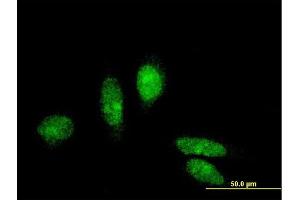 Immunofluorescence of monoclonal antibody to MTA3 on HeLa cell. (MTA3 抗体  (AA 416-515))