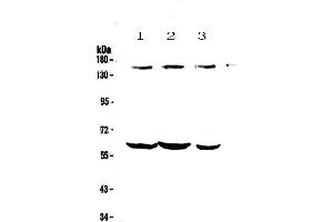 Western blot analysis of KCNH1 using anti-KCNH1 antibody . (KCNH1 抗体)