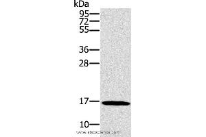 Western blot analysis of HT-29 cell, using SNCG Polyclonal Antibody at dilution of 1:800 (SNCG 抗体)