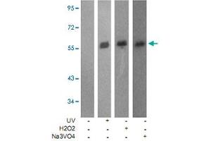 Western blot analysis of extracts from JK cells using LCK (phospho Y505) polyclonal antibody . (LCK 抗体  (pTyr505))