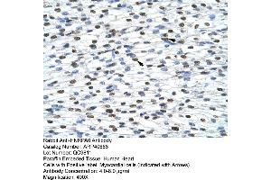 Rabbit Anti-HNRPA0 Antibody  Paraffin Embedded Tissue: Human Heart Cellular Data: Myocardial cells Antibody Concentration: 4. (HNRNPA0 抗体  (Middle Region))