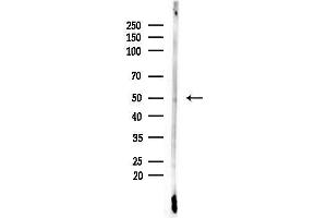 Western blot analysis of lysates from F10-LUC cells(LPS,4h treatment), using Phospho-p53 (Ser315) Antibody at 1/1000 dilution.