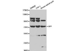 Western blot analysis of extracts of various cell lines, using APP antibody. (APP 抗体  (AA 190-290))