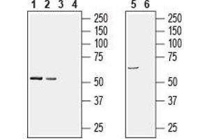 Western blot analysis of rat brain (lanes 1 and 3), mouse brain (lanes 2 and 4), (1:200) and human brain neuroblastoma SH-SY5Y cell line lysates (lanes 5 and 6), (1:600): - 1, 2, 5. (PACSIN1 抗体  (Intracellular))