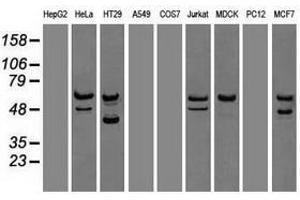 Image no. 6 for anti-Checkpoint Kinase 2 (CHEK2) antibody (ABIN1497498) (CHEK2 抗体)