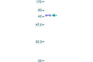 NK2 Homeobox 5 Protein (NKX2-5) (AA 1-324) (GST tag)